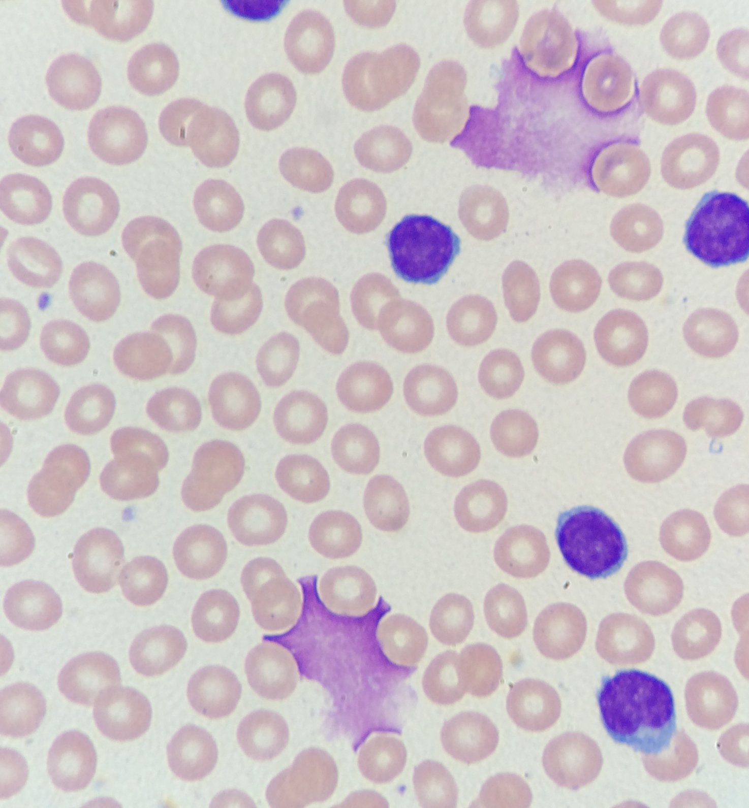 Advancing CLL Course